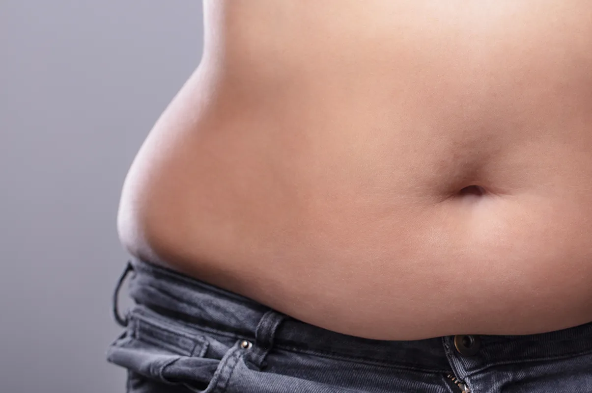 Localised fat deposits support image